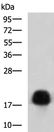 Rabbit Polyclonal Antibody to TNNC1