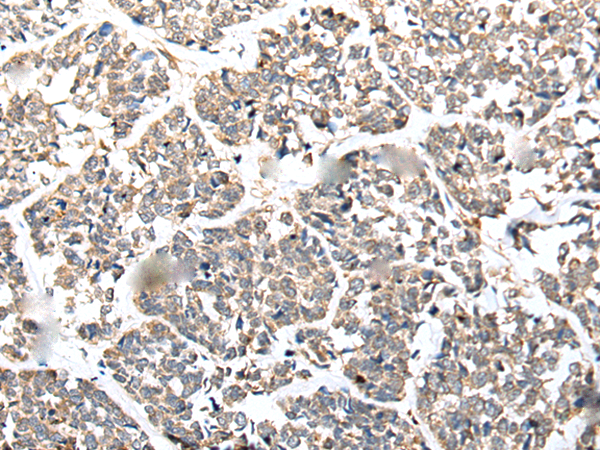 Rabbit Polyclonal Antibody to DHDH