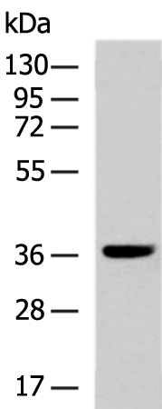 Rabbit Polyclonal Antibody to LSAMP