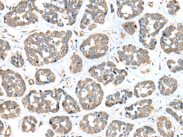Rabbit Polyclonal Antibody to DPYD