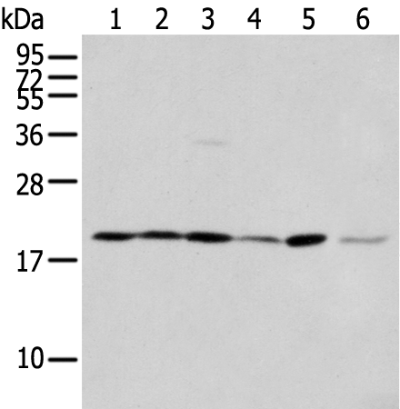 Rabbit Polyclonal Antibody to EEF1E1