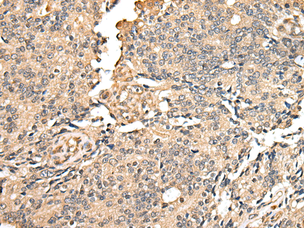 Rabbit Polyclonal Antibody to DYDC2