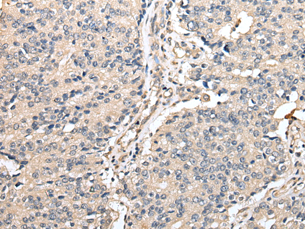 Rabbit Polyclonal Antibody to TRNAU1AP