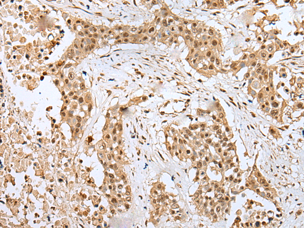 Rabbit Polyclonal Antibody to RHEBL1