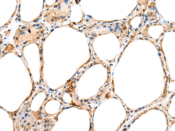 Rabbit Polyclonal Antibody to PLA2G12A