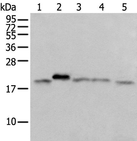 Rabbit Polyclonal Antibody to GM2A