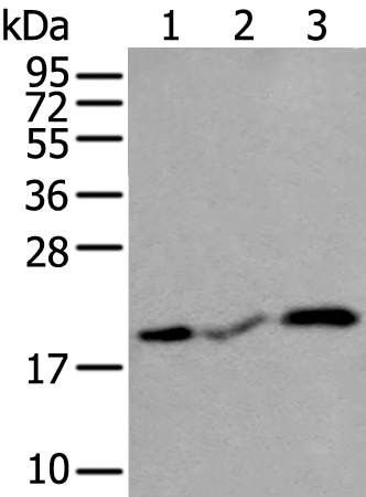 Rabbit Polyclonal Antibody to CSRP3