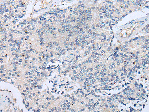 Rabbit Polyclonal Antibody to LYPD4