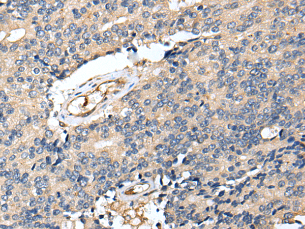 Rabbit Polyclonal Antibody to RAB39B