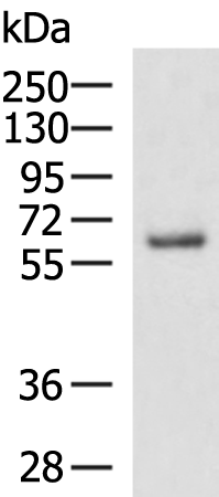 Rabbit Polyclonal Antibody to SETD3