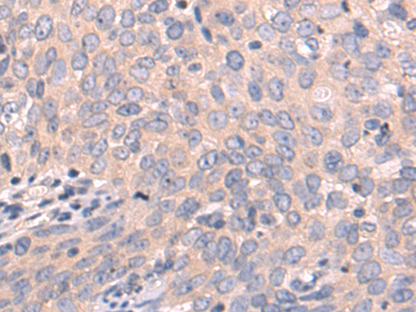 Rabbit Polyclonal Antibody to PLA2G4D