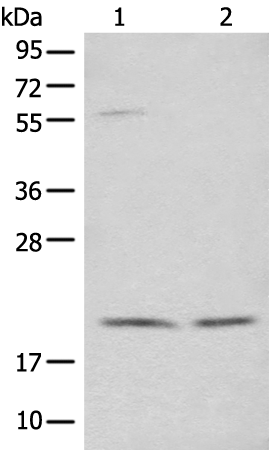 Rabbit Polyclonal Antibody to GAR1