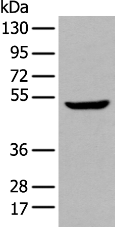 Rabbit Polyclonal Antibody to TINAGL1