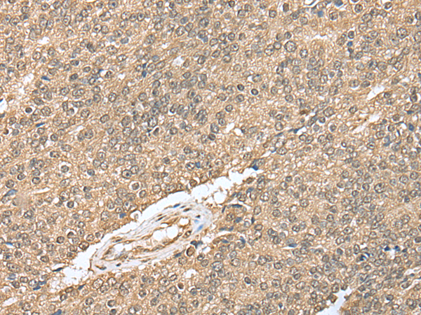 Rabbit Polyclonal Antibody to NUDCD3