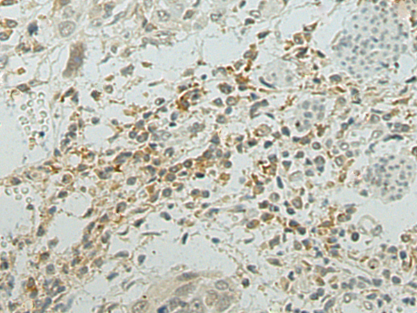 Rabbit Polyclonal Antibody to PRG2