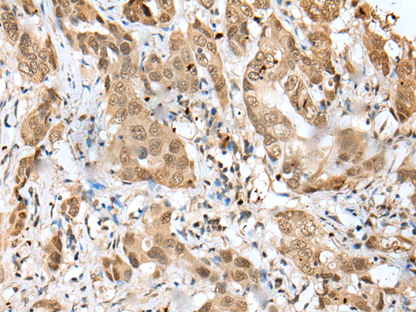 Rabbit Polyclonal Antibody to ZNF672