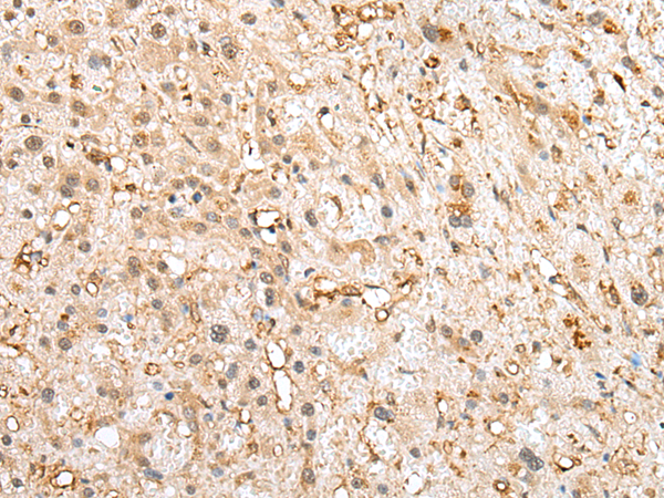 Rabbit Polyclonal Antibody to TWSG1