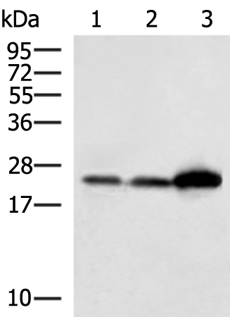 Rabbit Polyclonal Antibody to ATP6V1E2
