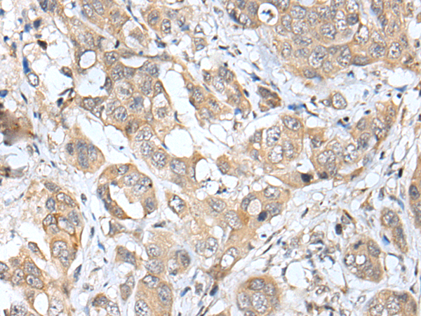 Rabbit Polyclonal Antibody to UBE2U