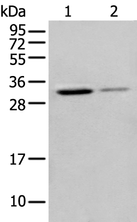 Rabbit Polyclonal Antibody to ING5