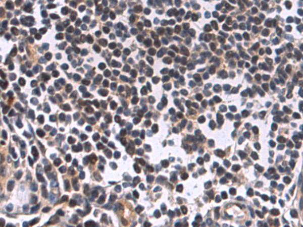 Rabbit Polyclonal Antibody to RNF114