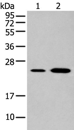 Rabbit Polyclonal Antibody to EBI3