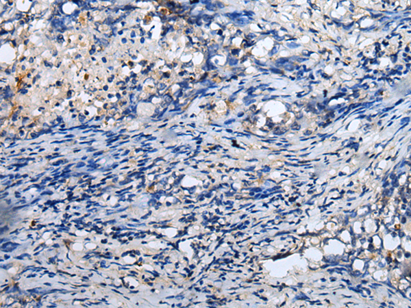 Rabbit Polyclonal Antibody to RNF141