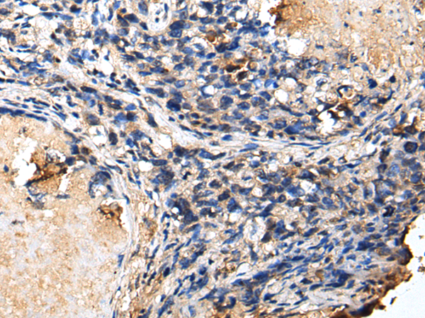 Rabbit Polyclonal Antibody to LYPLA2