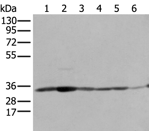 Rabbit Polyclonal Antibody to SFXN1