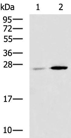 Rabbit Polyclonal Antibody to CBR4
