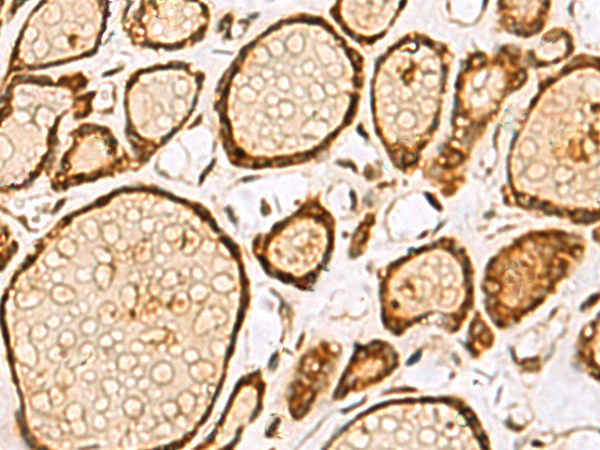 Rabbit Polyclonal Antibody to LRRC2