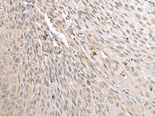 Rabbit Polyclonal Antibody to ALKBH8