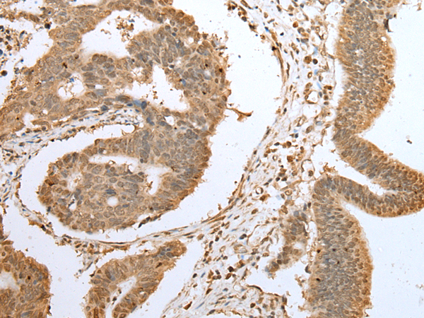 Rabbit Polyclonal Antibody to NAA60