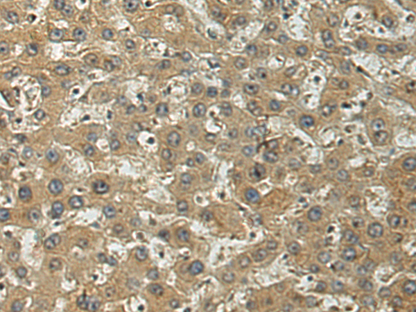 Rabbit Polyclonal Antibody to RWDD1