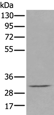 Rabbit Polyclonal Antibody to DECR2