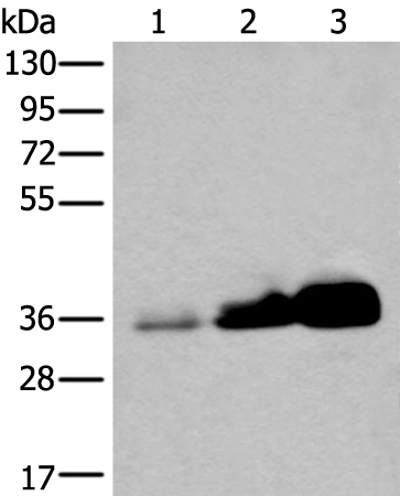 Rabbit Polyclonal Antibody to UBE2Z