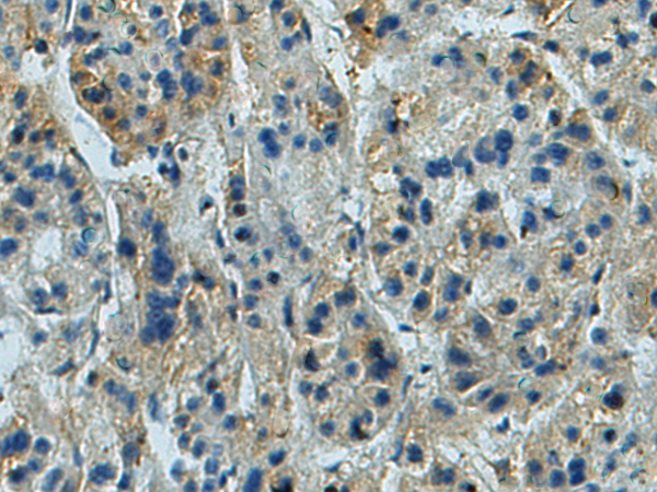 Rabbit Polyclonal Antibody to LIN37