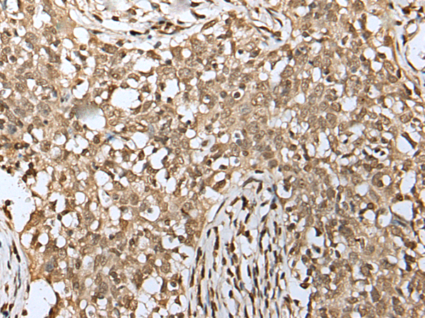 Rabbit Polyclonal Antibody to NSMCE2