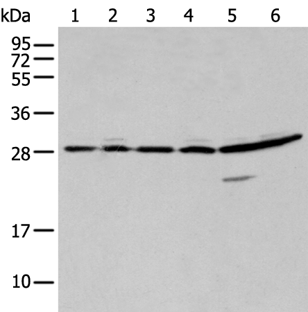 Rabbit Polyclonal Antibody to SFN