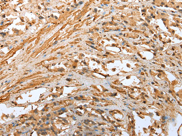 Rabbit Polyclonal Antibody to TPM4