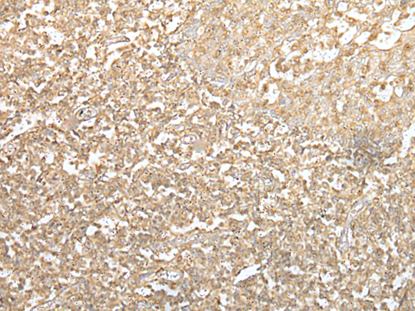 Rabbit Polyclonal Antibody to SPIC
