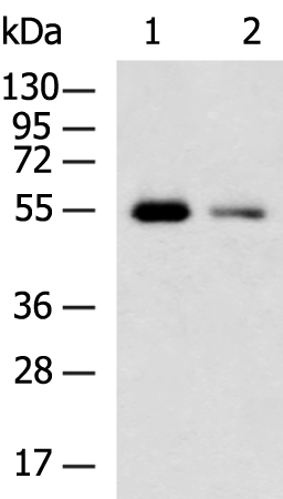 Rabbit Polyclonal Antibody to UGT3A1