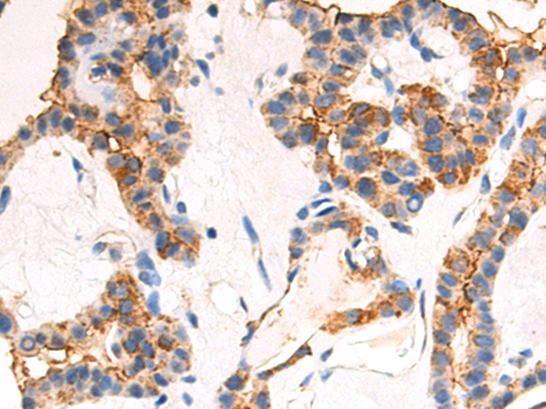 Rabbit Polyclonal Antibody to PRNP