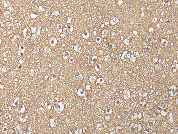 Rabbit Polyclonal Antibody to NIPA1