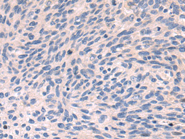 Rabbit Polyclonal Antibody to SNF8