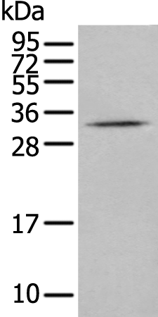 Rabbit Polyclonal Antibody to CISH