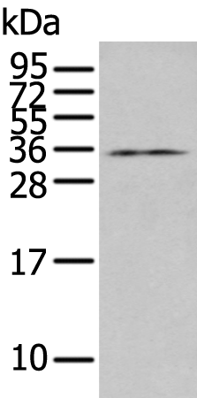 Rabbit Polyclonal Antibody to HDHD2