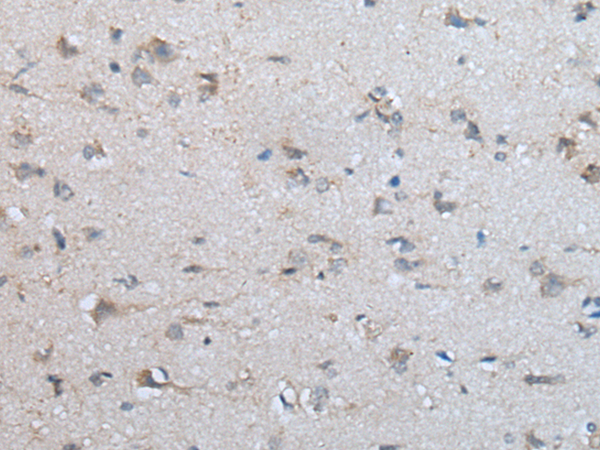 Rabbit Polyclonal Antibody to DPM1