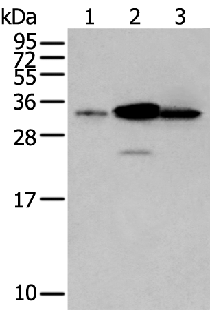 Rabbit Polyclonal Antibody to LASP1