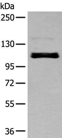 Rabbit Polyclonal Antibody to ZNF281